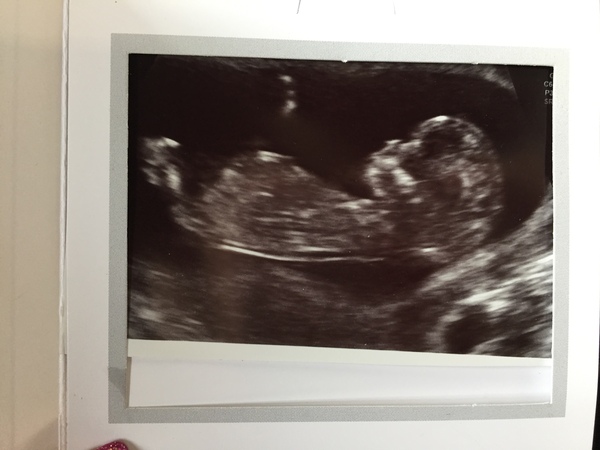 boy or girl?