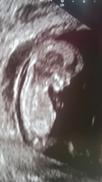 12 week scan went well! help me guess??
