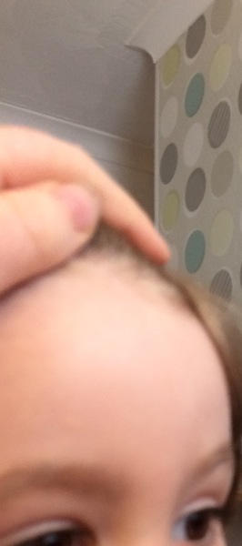Pics attached: is this normal?