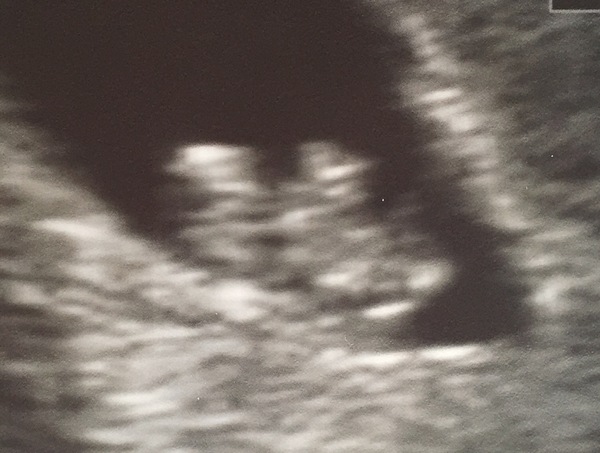 December 2017 #3 - Beware! There is much talk about food on this thread!