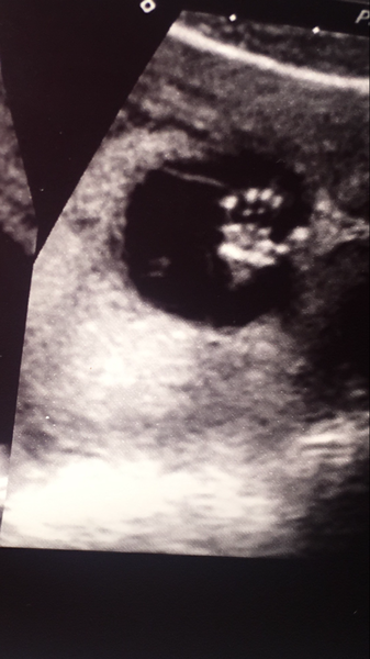 Biscuits, official scans & the end of the trimester - Later November due dates this way...