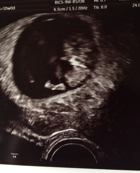 First Time Pregnancy (2)