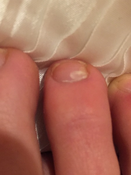 Any experts here, what's this on my toe nail???