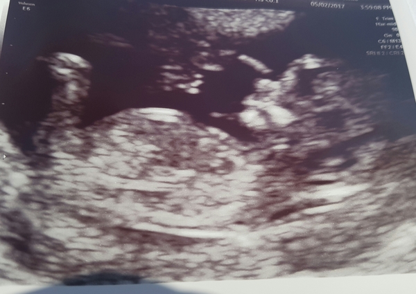 PMA Express to BFP Thread #5