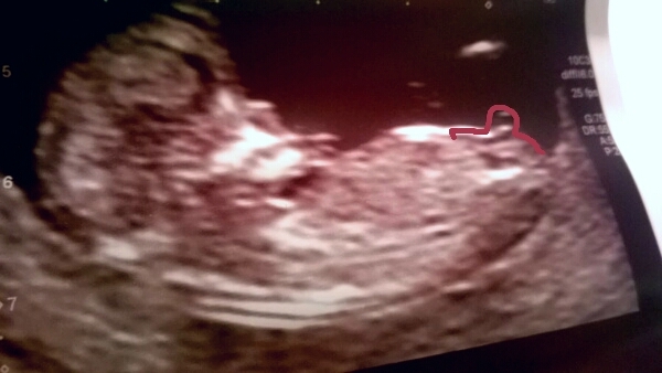12 week scan went well! help me guess??