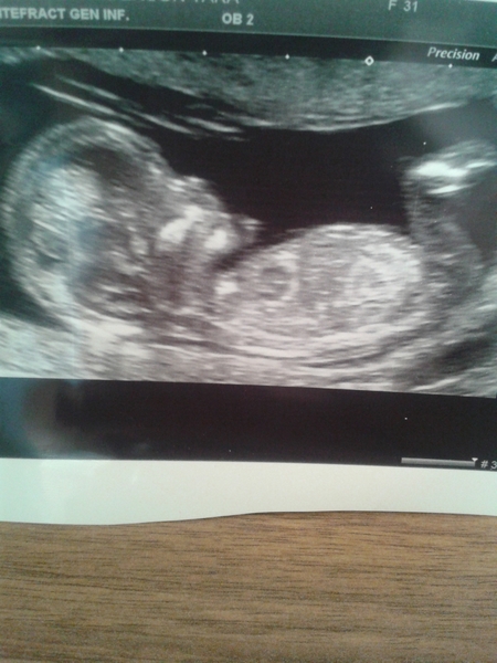 Gender guesses please already have 3 girls
