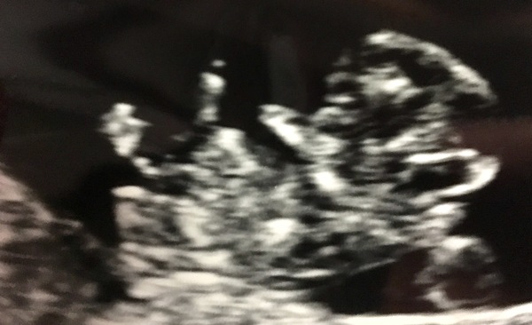 Getting Ready For Baby Challenge - Thread 8