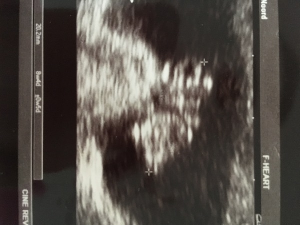 January 2018 babies!