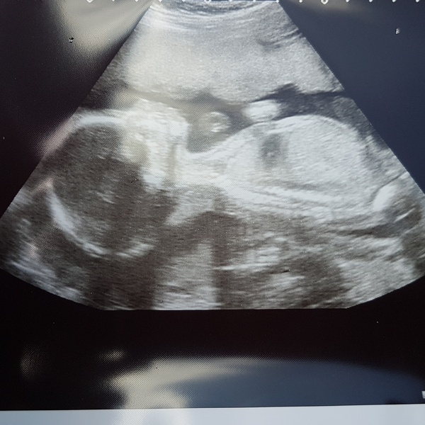 First Time Pregnancy (2)