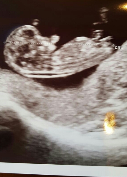Boy or girl?