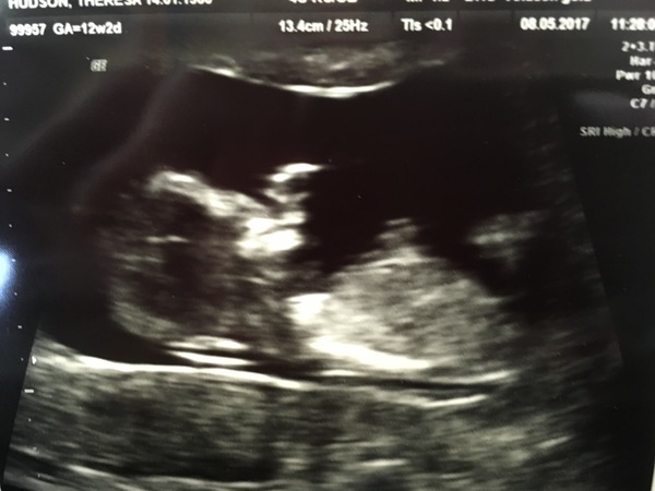 Biscuits, official scans & the end of the trimester - Later November due dates this way...