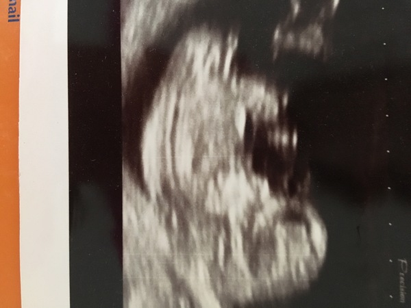 January 2018 babies!