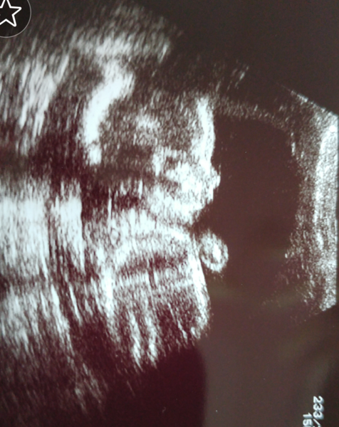 Gender guesses? Heres our little one at 12+2