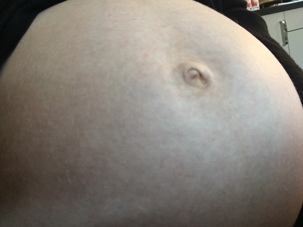 Slim people - did your belly button pop?