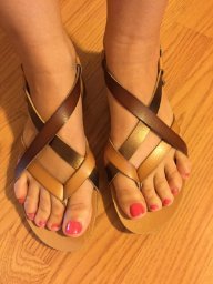 Please help me look stylish while battling psoriasis