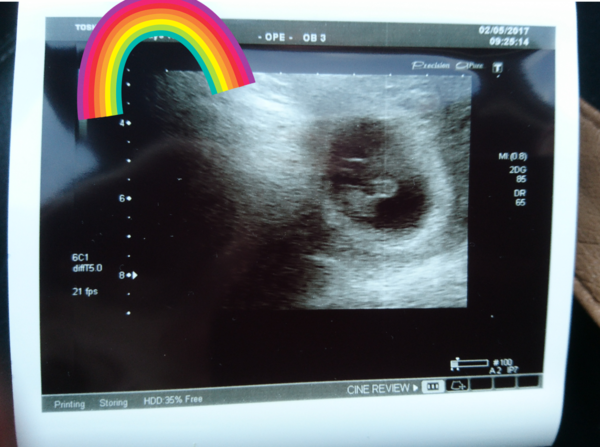 December 2017 #3 - Beware! There is much talk about food on this thread!