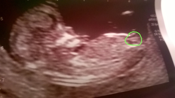 12 week scan went well! help me guess??