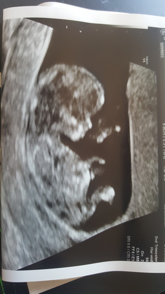 First Time Pregnancy (2)