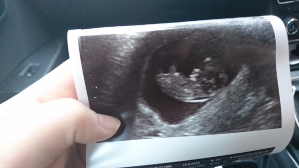 First Time Pregnancy (2)