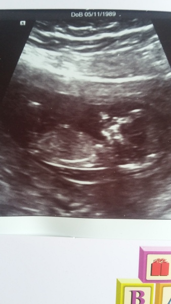 guess the gender? :)