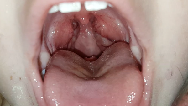 NEED HELP 3 YEAR OLD BEEN POORLY FOR 4 WEEKS WITH NO CHANGE. TONSILITIS