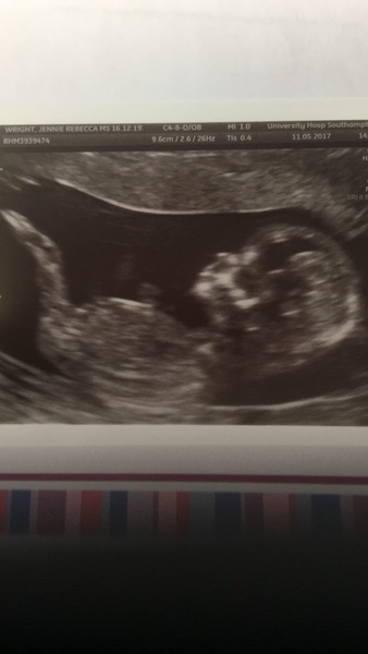 Biscuits, official scans & the end of the trimester - Later November due dates this way...