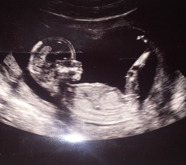 Biscuits, official scans & the end of the trimester - Later November due dates this way...