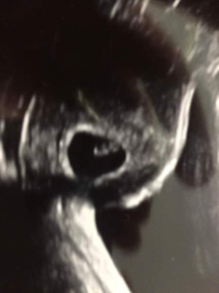 January 2018 babies - early scans and midwife appointments!