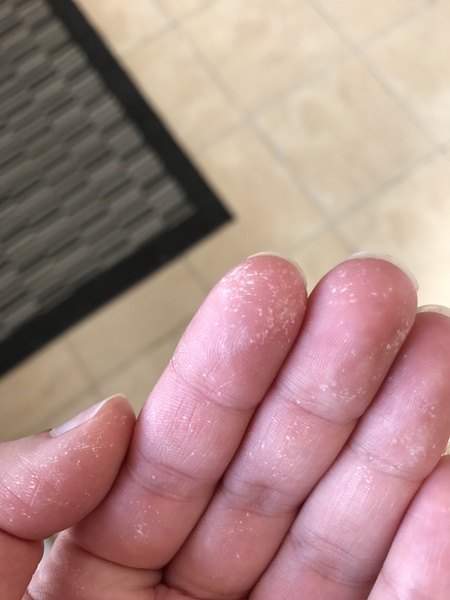 What is on my hand after gardening?