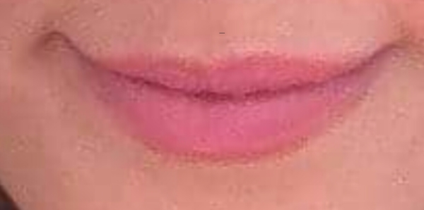Big lips