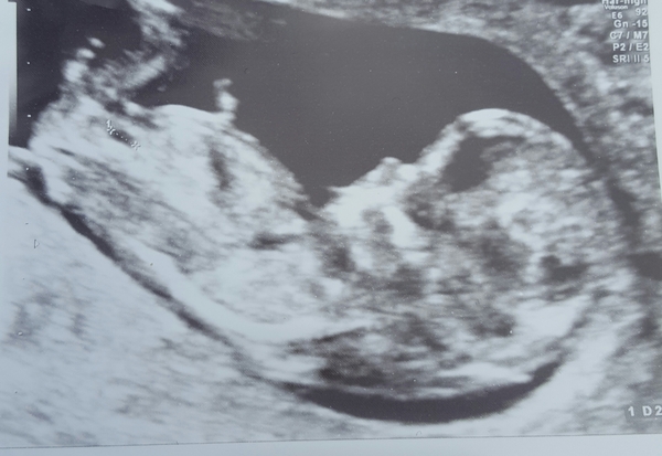 All November Babies Welcome, bring on the 12 week scans