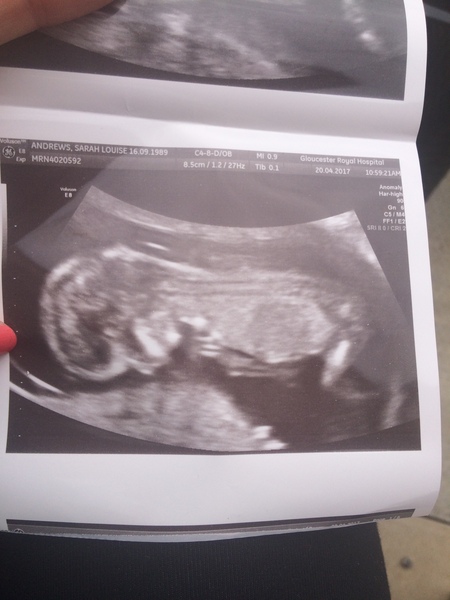 Do you think girl or boy?