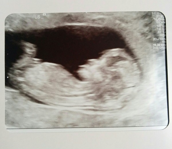 Biscuits, official scans & the end of the trimester - Later November due dates this way...