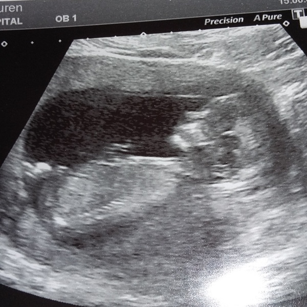 Girl or boy?