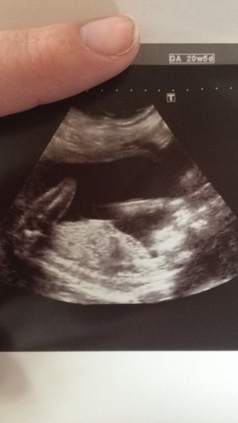BOY or GIRL