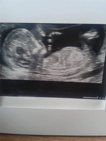 Gender guesses please already have 3 girls