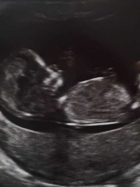 Biscuits, official scans & the end of the trimester - Later November due dates this way...