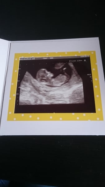 Biscuits, official scans & the end of the trimester - Later November due dates this way...