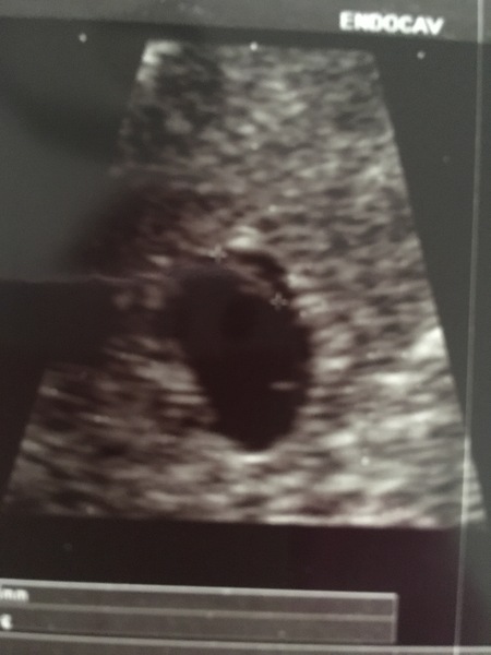 January 2018 babies!