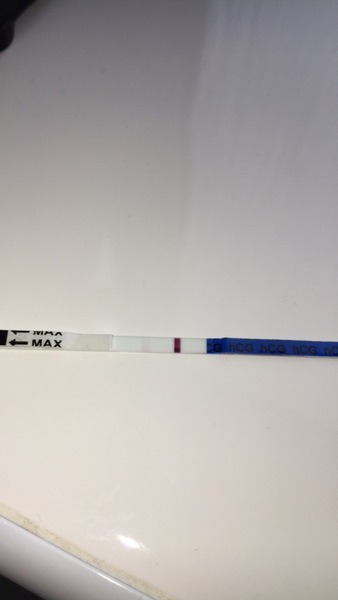 AF 4 days late, thick milky discharge, BFN