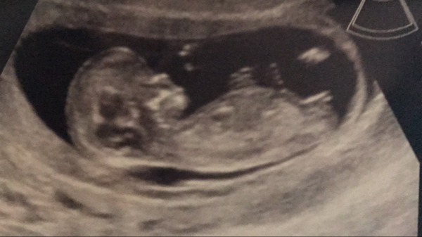 Biscuits, official scans & the end of the trimester - Later November due dates this way...