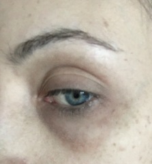 My (eye) bags