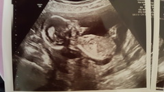 First Time Pregnancy (3)