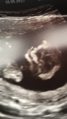 Baby's sex?