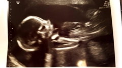 First Time Pregnancy (2)