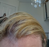 HAIR-ELP ME!!! (with pics)