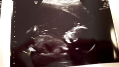 First Time Pregnancy (2)