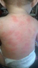 Rash, any ideas? (pics included)