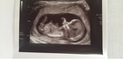 Gender scan tomorrow!