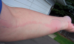 ...to wish mosquitos would just die?